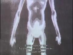 Black Jack op